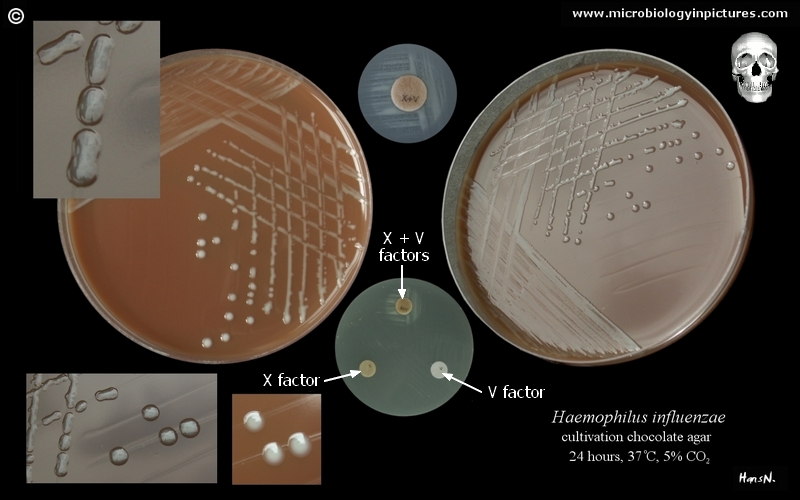 haemophilus influenzae on agar plate